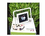 digital photo frame